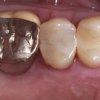 Farbod Family Dental Coronado-cosmetic