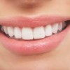 new day family dental Scott AFB-smile