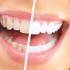 heatland dental care beale afb- teeth