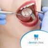 Dental Check up in Catania, Italy