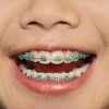 Dr. Tanya Lawhon NAS Kingsville-braces