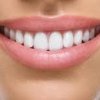 Hoyner Family Dentistry-smile