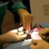 Dental- Scott AFB- tooth extraction Dental- Scott AFB- tooth extraction