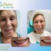 Lopez Dental Care yuma arizona- patient 2