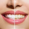 pearl family dental care-white teeth