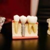 Paradise Valley Dental Studios-Travis AFB-tooth