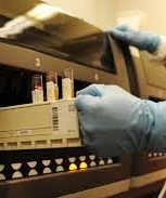 Lab Tests &amp; Radiology- Scott AFB-test tubes