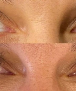 Eyebrow Styling in Rota, Spain