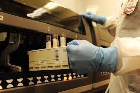 Lab Tests & Radiology- Scott AFB-test tubes Lab Tests & Radiology- Scott AFB-test tubes